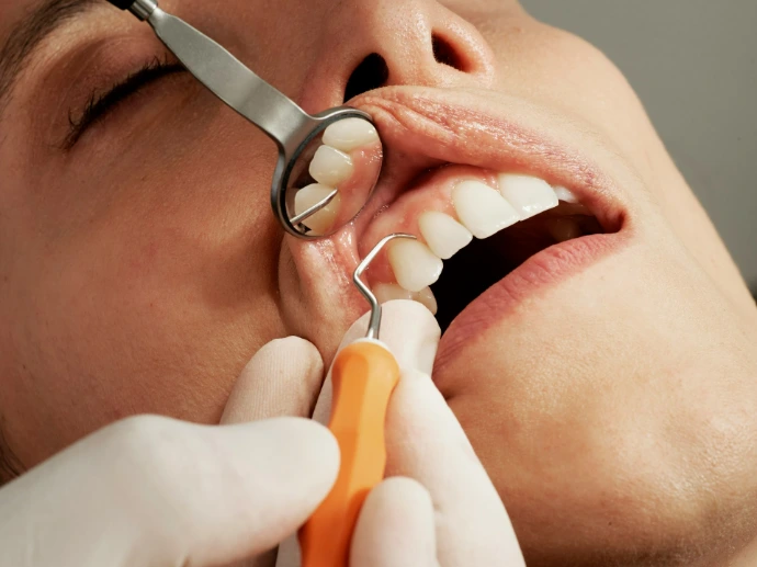 Dentist using a periodontal probe and mouth mirror to examine teeth and assess gum health during a dental diagnostic procedure